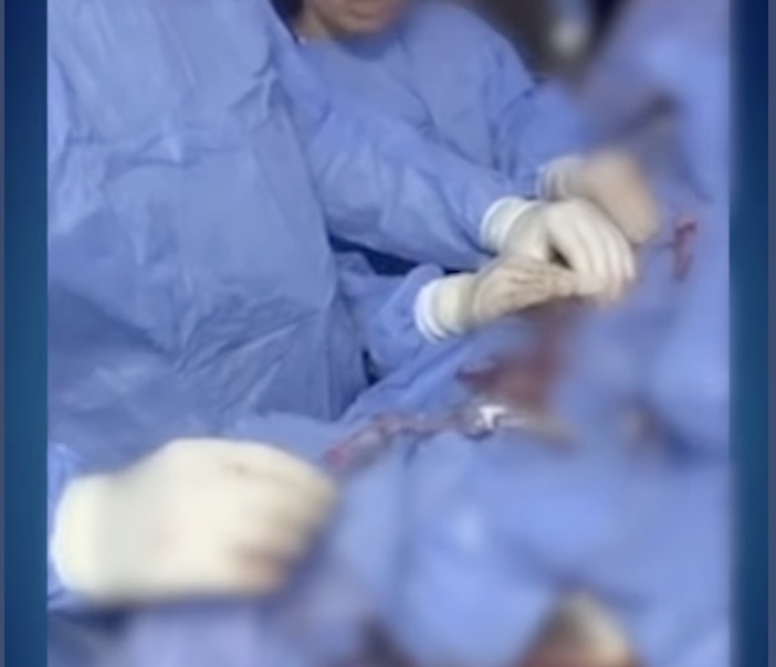 مركز قصر الأعصاب لجراحات وقسطرة المخ والأعصاب