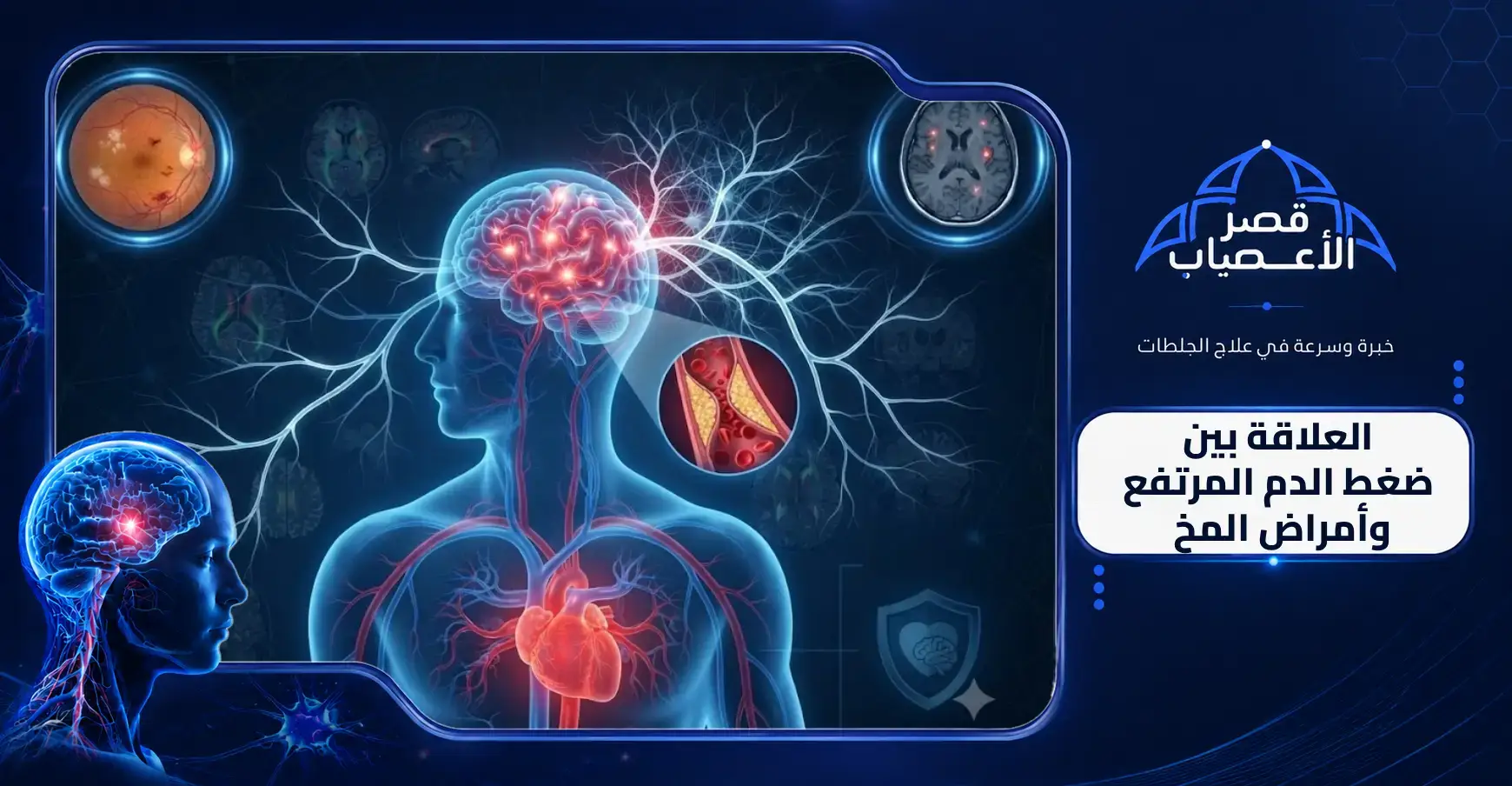 العلاقة بين ضغط الدم المرتفع وأمراض المخ