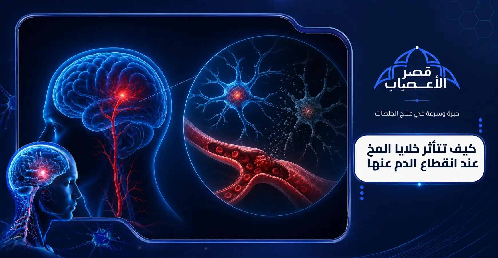 كيف تتأثر خلايا المخ عند انقطاع الدم عنها